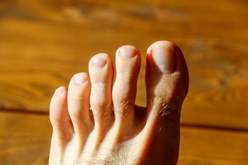 足の爪の写真