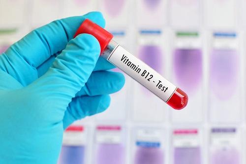 ビタミン B12 テストの血液サンプルをテスト チューブ