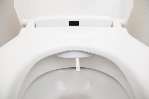 カビを撒き散らしてるかも…？放置はNG『ウォシュレットのノズル』はこうやって掃除すれば簡単♪