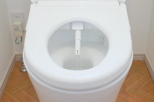 ＜ウォシュレットのノズル＞雑菌やカビの巣窟ってホント？→“手間”をかけずに【清潔に保つ掃除テク】教えるからやってみて！