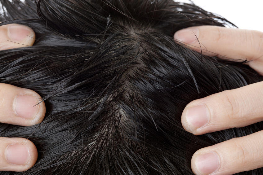 頭皮がかゆい驚きの原因と対処方法を徹底解説 洗髪が重要 身嗜み オリーブオイルをひとまわし