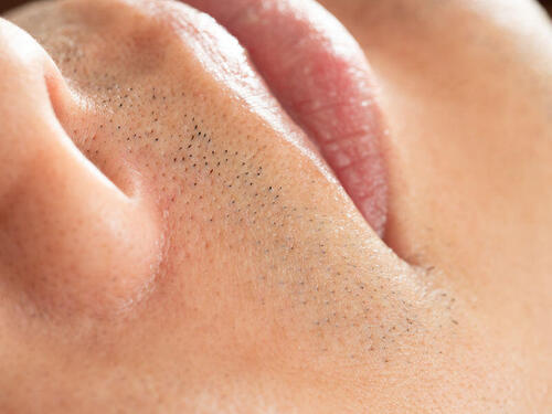 鼻の下のニキビに悩んでいる男性必見！対策方法や予防策を紹介