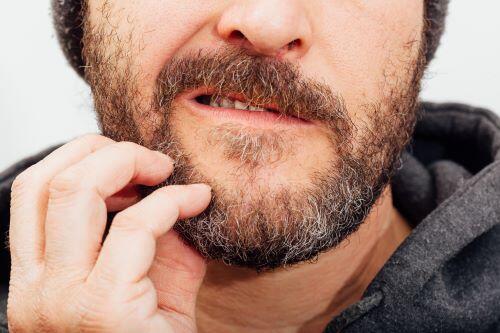 髭がかゆい原因は？市販薬や正しい髭剃りなどの対処法も解説！