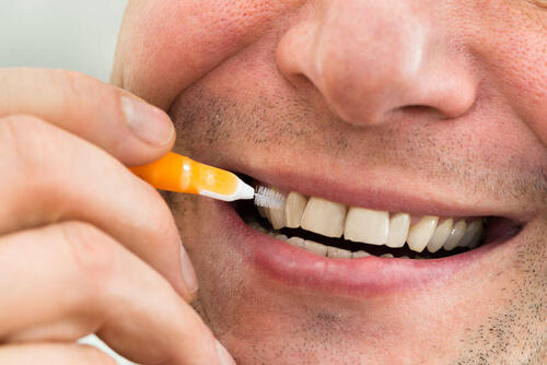歯間ブラシを使うと出血してしまう原因は？原因別の対処法を解説！