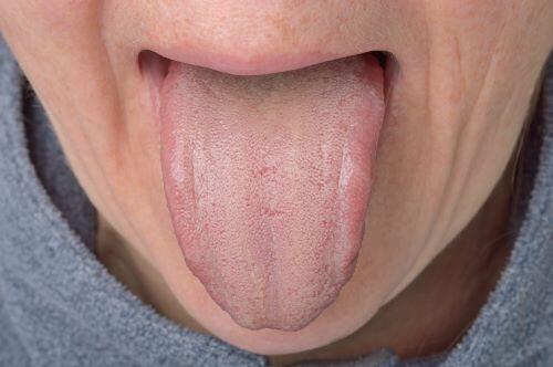 舌の汚れの取り方とは 舌に汚れがつく原因と対処や予防法を徹底解説 身嗜み オリーブオイルをひとまわし