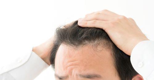 前髪が薄い男性の原因や対策は セットのコツや似合う髪型も紹介 身嗜み オリーブオイルをひとまわし