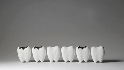 重曹で虫歯対策ができるって本当 歯周病予防やホワイトニング効果も 身嗜み オリーブオイルをひとまわし